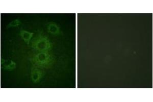 Immunofluorescence analysis of HuvEc cells, using BIK (Ab-33) Antibody. (BIK 抗体  (AA 18-67))