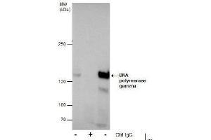 IP Image Immunoprecipitation of DNA polymerase gamma protein from MCF-7 whole cell extracts using 5 μg of DNA polymerase gamma antibody, Western blot analysis was performed using DNA polymerase gamma antibody, EasyBlot anti-Rabbit IgG  was used as a secondary reagent. (POLG 抗体  (C-Term))