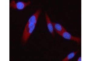 IF analysis of STAT2 using anti-STAT2 antibody (ABIN5692942). (STAT2 抗体)