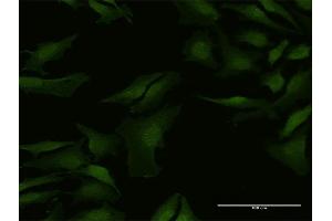 Immunofluorescence of purified MaxPab antibody to C9orf156 on HeLa cell. (C9orf156 抗体  (AA 1-441))