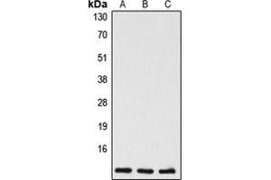 Western blot analysis of Caspase 5 p10 expression in Jurkat (A), mouse liver (B), rat liver (C) whole cell lysates. (Caspase 5 p10 抗体  (C-Term))