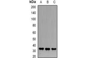 Western blot analysis of Emerin expression in Hela (A), Jurkat (B), PC3 (C) whole cell lysates. (Emerin 抗体)