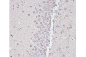 Immunohistochemistry (Paraffin-embedded Sections) (IHC (p)) image for anti-Protein Kinase, AMP-Activated, alpha 1 Catalytic Subunit (PRKAA1) (pThr172), (pThr183) antibody (ABIN7265094)