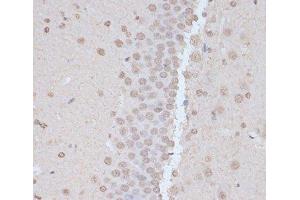 Immunohistochemistry of paraffin-embedded Rat brain using Phospho-PRKAA1(T183)/PRKAA2(T172) Polyclonal Antibody at dilution of 1:100 (40x lens).
