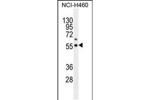 Western blot analysis in NCI-H460 cell line lysates (35ug/lane). (COQ6 抗体  (N-Term))