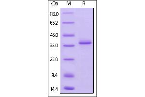 SDS-PAGE (SDS) image for Tumor Necrosis Factor Receptor Superfamily, Member 17 (TNFRSF17) (AA 1-49) (Active) protein (Fc Tag) (ABIN6253667)