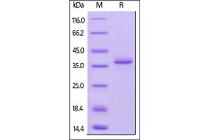 Mouse BCMA, Fc Tag on  under reducing (R) condition. (BCMA Protein (AA 1-49) (Fc Tag))