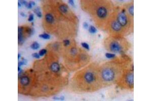 IHC-P analysis of Liver tissue, with DAB staining. (ADH1 抗体  (AA 169-370))
