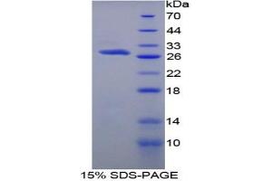 SDS-PAGE analysis of Rat Protein S Protein. (PROS1 蛋白)