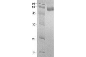 Western Blotting (WB) image for Arrestin, beta 1 (ARRB1) (Transcript Variant 1) protein (His tag) (ABIN2714947)