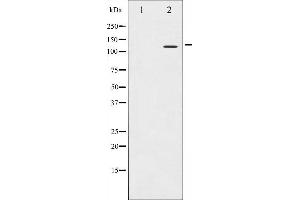 Western blot analysis of Integrin beta3 expression in NIH-3T3 whole cell lysates,The lane on the left is treated with the antigen-specific peptide. (Integrin beta 3 抗体  (C-Term))
