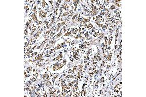 IHC analysis of SUCLG2 using anti-SUCLG2 antibody (ABIN7601694).