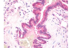 Immunohistochemistry (IHC) image for anti-DnaJ (Hsp40) Homolog, Subfamily B, Member 6 (DNAJB6) (AA 1-116) antibody (ABIN1978869)
