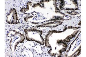 IHC analysis of Ran using anti-Ran antibody . (RAN 抗体  (AA 2-216))
