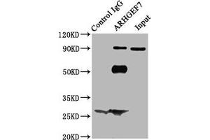 Immunoprecipitating ARHGEF7 in Hela whole cell lysate Lane 1: Rabbit control IgG (1 μg) instead of ABIN7167994 in Hela whole cell lysate. (ARHGEF7 抗体  (AA 1-250))