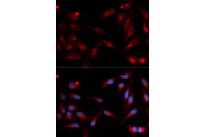 Immunofluorescence analysis of U2OS cells using ADAM9 antibody (ABIN5973121). (ADAM9 抗体)
