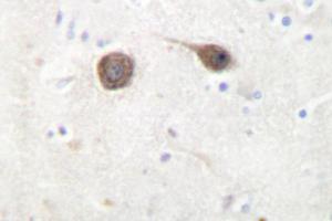 Image no. 1 for anti-C-Jun-Amino-Terminal Kinase-Interacting Protein 2 (JIP-2) antibody (ABIN272223) (IB2 抗体)