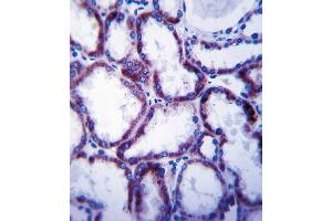 SLC22A1 Antibody (C-term) (ABIN657865 and ABIN2846821) immunohistochemistry analysis in formalin fixed and paraffin embedded human kidney tissue followed by peroxidase conjugation of the secondary antibody and DAB staining. (SLC22A1 抗体  (C-Term))