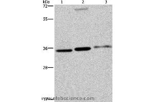 Western blot analysis of A375, 293T and SKOV3 cell, using PITX2 Polyclonal Antibody at dilution of 1:250 (PITX2 抗体)