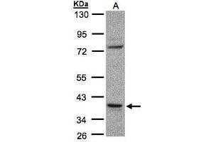 WB Image Sample(30 ug whole cell lysate) A:Raji , 10% SDS PAGE antibody diluted at 1:1000 (CCDC68 抗体)
