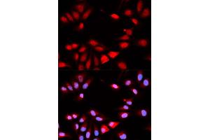 Immunofluorescence (IF) image for anti-Regulator of Calcineurin 1 (RCAN1) antibody (ABIN1876514) (RCAN1 抗体)