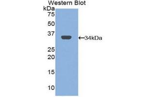 Western Blotting (WB) image for anti-Mannose Receptor, C Type 1 (MRC1) (AA 225-492) antibody (ABIN1859879) (Macrophage Mannose Receptor 1 抗体  (AA 225-492))