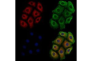 ABIN6261363 and ABIN6278853 staining Hela cells by IF/ICC. (CALY 抗体  (Internal Region))