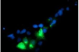 Immunofluorescence (IF) image for anti-Golgi Membrane Protein 1 (GOLM1) antibody (ABIN1498494) (GOLM1 抗体)