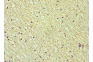 Immunohistochemistry of paraffin-embedded human brain tissue using ABIN7144027 at dilution of 1:100 (Amphiphysin 抗体  (AA 340-620))