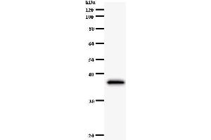 Western Blotting (WB) image for anti-Cbl Proto-Oncogene B, E3 Ubiquitin Protein Ligase (CBLB) antibody (ABIN933045) (Cbl Proto-Oncogene B, E3 Ubiquitin Protein Ligase (CBLB) 抗体)