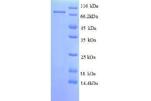 SDS-PAGE (SDS) image for Proteasome (Prosome, Macropain) 26S Subunit, Non-ATPase, 11 (PSMD11) (AA 2-422), (full length) protein (GST tag) (ABIN7479249)