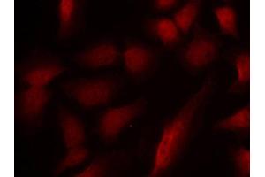 Immunofluorescence staining of methanol-fixed Hela cells using using Phospho-GATA1-S310 antibody. (GATA1 抗体  (pSer310))