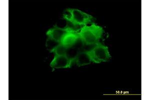 Immunofluorescence of monoclonal antibody to CCT2 on A-431 cell. (CCT2 抗体  (AA 117-217))