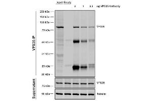 Immunoprecipitation (IP) image for anti-Vacuolar Protein Sorting 35 (VPS35) antibody (PerCP) (ABIN6932953)
