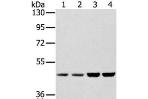 Western Blot analysis of Hela, Raji, 231 and K562 cell using SSB Polyclonal Antibody at dilution of 1:400 (SSB 抗体)