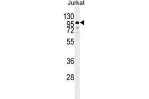 ZNF841 Antibody (N-term) western blot analysis in Jurkat cell line lysates (35 µg/lane). (ZNF841 抗体  (N-Term))