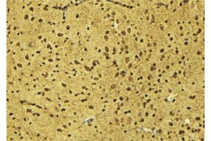 ABIN6275194 at 1/100 staining Mouse brain tissue by IHC-P. (Msx2/Hox8 抗体  (Internal Region))
