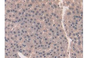 Used in DAB staining on fromalin fixed paraffin- embedded liver tissue (Midkine 抗体  (AA 22-140))