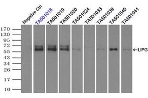 Image no. 8 for anti-Lipase, Endothelial (LIPG) antibody (ABIN1499165) (LIPG 抗体)