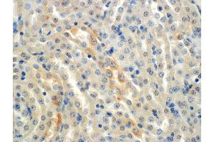 Immunohistochemistry (IHC) image for anti-Sodium Channel, Nonvoltage-Gated 1 alpha (SCNN1A) (AA 46-68) antibody (PE) (ABIN5066873)