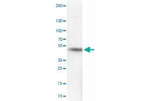 Western Blot analysis of RT-4 cell lysate with CA12 monoclonal antibody, clone CL0280 . (CA12 抗体)