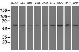 Western Blotting (WB) image for anti-Syntrophin, alpha 1 (Dystrophin-Associated Protein A1, 59kDa, Acidic Component) (SNTA1) antibody (ABIN2733122)