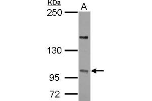Western Blotting (WB) image for anti-Protein Phosphatase 4, Regulatory Subunit 4 (PPP4R4) (C-Term) antibody (ABIN1491842) (PPP4R4 抗体  (C-Term))
