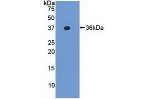 Detection of Recombinant LFA1a, Human using Polyclonal Antibody to Lymphocyte Function Associated Antigen 1 Alpha (CD11a) (ITGAL 抗体  (AA 809-1066))