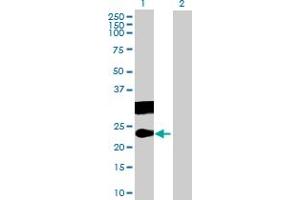 Western Blot analysis of CT45A3 expression in transfected 293T cell line by CT45A3 MaxPab polyclonal antibody. (CT45A3 抗体  (AA 1-189))