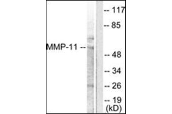 MMP11 抗体  (Internal Region)