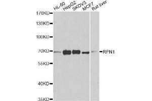 Western blot analysis of extracts of various cell lines, using RPN1 antibody. (RPN1 抗体  (AA 20-280))