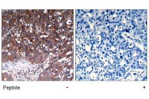 Image no. 1 for anti-Insulin-Like Growth Factor 1 Receptor (IGF1R) (Tyr1280) antibody (ABIN197576) (IGF1R 抗体  (Tyr1280))