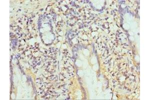Immunohistochemistry of paraffin-embedded human small intestine tissue using ABIN7164972 at dilution of 1:100 (PSMB1 抗体  (AA 1-273))