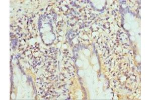 Immunohistochemistry of paraffin-embedded human small intestine tissue using ABIN7164972 at dilution of 1:100
